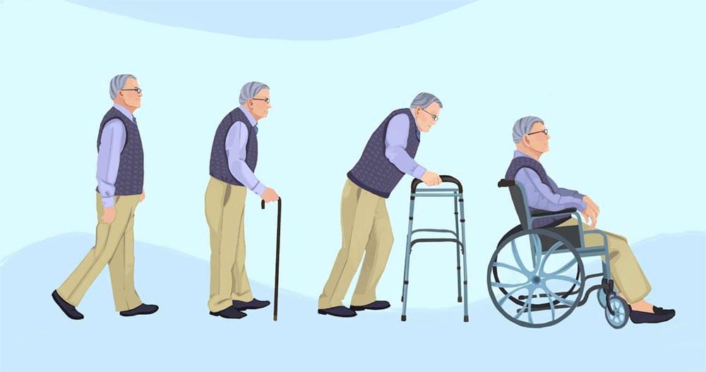 پارکینسون