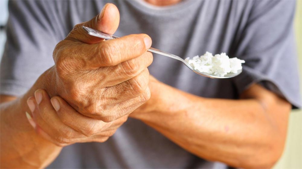 بیماری پارکینسون