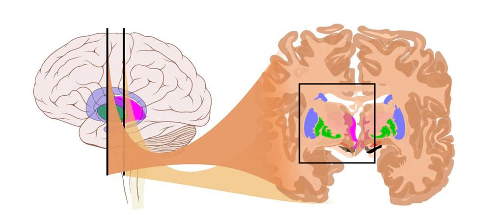 گلوبوس پالیدوس در مغز