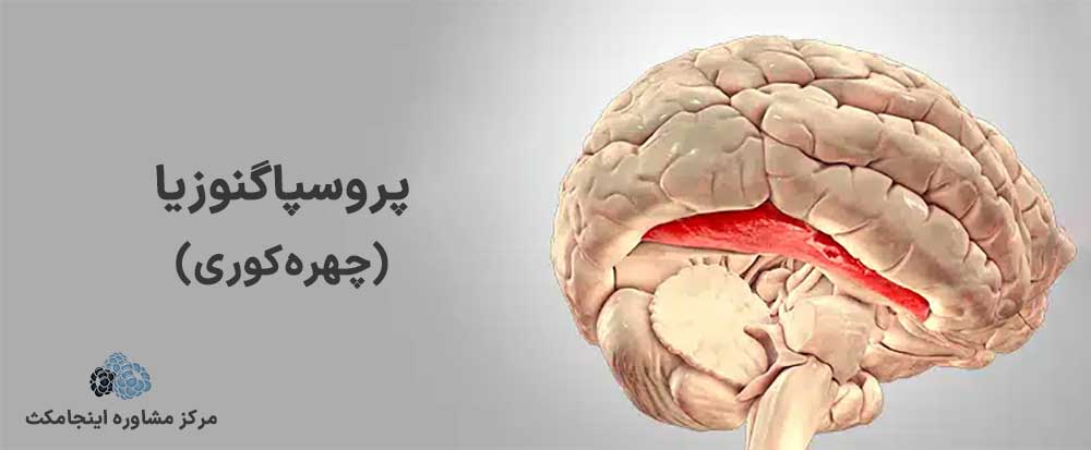 ادراک پریشی چهره ای