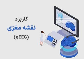 نقشه مغزی یا qEEG و کاربرد آن چیست؟
