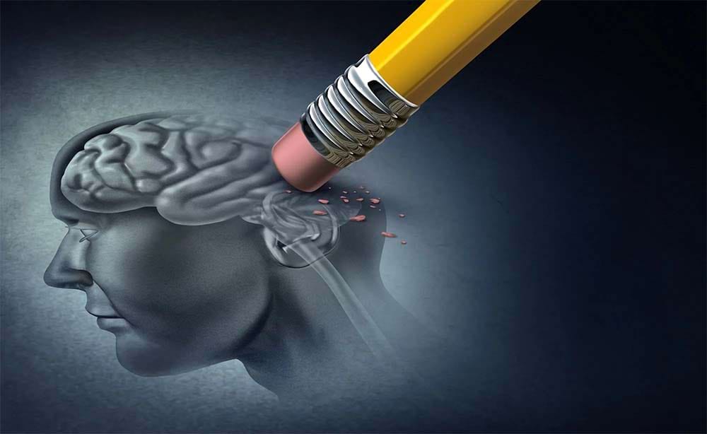 علائم آلزایمر