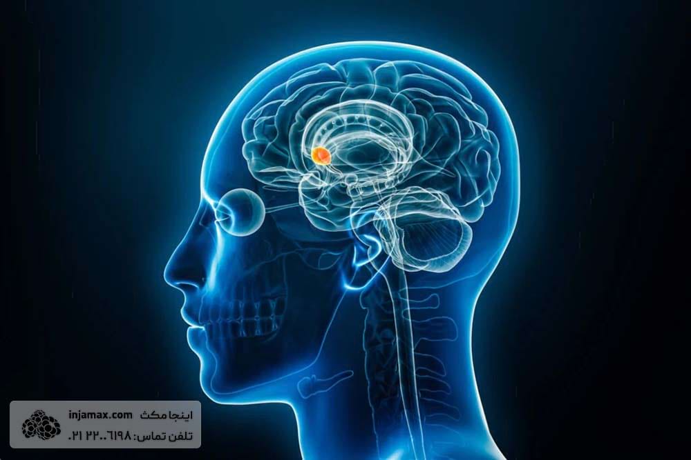 هسته اکومبنس